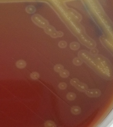 Figure 5 Corneal scraping specimen culture by blood agar plate at 37°C for 36 hours. A large number of white, flat, slightly protruding, dry colonies were observed, with smooth, translucent surface and viridans hemolysis.