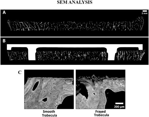 Figure 8. SEM images of a tibia without an implant (A) and a different tibia with cemented implant (B), with Gray = Bone, White = Implant, and Black = Soft Tissue/Cement. The cut surface is noticeably flattered on the specimen that has an implant. Comparison of a smooth vs. frayed trabecula (C) from SEM image. For the femur with an implant, the ratio of smooth vs. frayed trabecular was similar to the femur without an implant (67 vs. 68% smooth trabeculae), but for the tibia, the one with an implant had a higher amount of smooth trabeculae (37 vs. 47%). To create the SEM images, one section from each specimen was ground and polished to an optical finish. The polished ∼2 mm-thick sections were coated with a thin conductive layer of carbon for ∼25 s and imaged using a JEOL JSM-6610 SEM equipped with a backscatter electron (BSE) detector and associated imaging software. Digital BSE images were captured along the entire resected surface and then stitched together for (A) and (B).