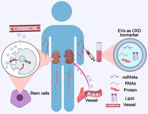 Figure 2 EVs originating from various sources such as stem cells, the kidney, and other organs play a crucial role in regulating both the physiological functions and pathological processes within the kidney. Additionally, EVs derived from plasma hold potential as biomarkers for detecting CKD. The pink arrow represents EVs could be transported to kidney. The brown arrows represent the biogenesis and release of EVs.
