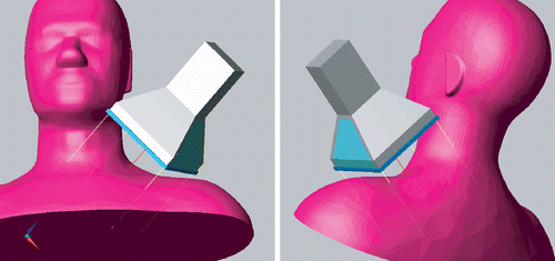 Figure 12. Overview of the model configuration: the LCA targeted at the posterior triangle of the neck of the SAM phantom (water bolus not shown). The lines show the projection of the centre and extent of the applicator horn on the anatomy.