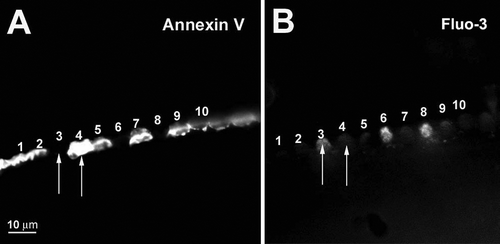 Figure 8.  Cells with high levels of Ca2 +  have low PS externalization in vitro. (A) Annexin V labeling. PS externalization and blebs occur variably from cell to cell and result from an imbalance of endo- and exocytosis Citation[24]. (B) Fluo-3 AM labeling. Note that high fluorescence signals indicating elevated Ca2 +  were associated with cells with no apparent external PS (e.g., cell 3) and vice versa (cell 4).