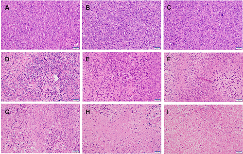 Figure 8 H&E staining images of the tumors with the treatments of (A) 5% glucose, (B) PSC, (C) ICG (NIR), (D) PSC/ICG@, (E) PSC/ICG@ (NIR), (F) DOX·HCl, (G) DOX·HCl+ICG (NIR), (H) PSC/ICG@+DOX, and (I) PSC/ICG@+DOX (NIR), respectively. Scale bar, 20 μm.
