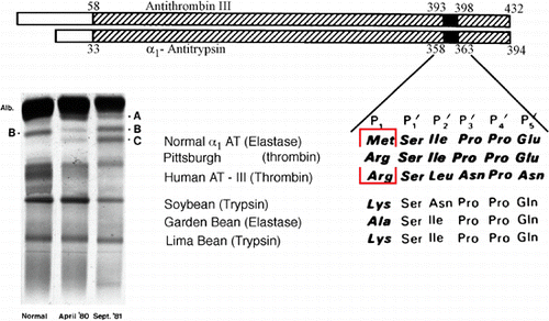 Figure 3. Antitrypsin Pittsburgh. Alignment of the sequences (above), and comparison with the known reactive centers of the smaller protease inhibitors (below) revealed the homologous reactive centers of antithrombin and α1‐antitrypsin. This deductive siting was confirmed by the identification by Owen Citation[62] of the mutation in the Pittsburgh variant of α1‐antitrypsin, where the mutation of the reactive center methionine to arginine converted the antitrypsin to an inhibitor of thrombin. The use of agarose gel introduced by Laurell Citation[16] greatly increased the discrimination of plasma protein electrophoresis, as illustrated on left with the separation of the Pittsburgh (C) from normal (B) α1‐antitrypsin. Note also the presence of proalbumin (A) and the variation in all these components in quiescent (April 1980) versus the acute phase (September 1981) states (reproduced with permission from Ref. Citation[62] Copyright Massachusetts Medical Society). (View this art in color at www.dekker.com.)