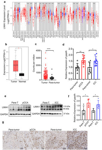 Figure 1. Lima1 expression is upregulated in cholangiocarcinoma.