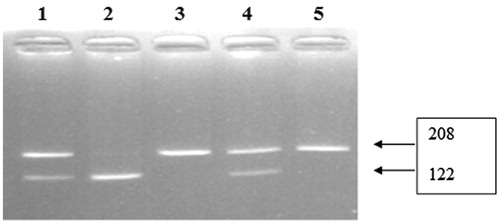 Figure 1. Genotyping of VEGF gene C-936T polymorphisms. Lane 1 and 4: C/T genotype (208, 122, and 86 bp), Lane 2: T/T genotype (122 and 86 bp), Lane 3 and 5: C/C genotype (208 bp).