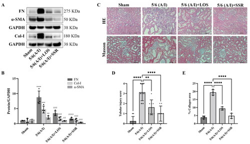 Figure 7. Effects of SSR on renal injury and fibrosis in 5/6 (A/I) rats. (A) The expression of FN, Col-I, and α-SMA proteins were determined by western blot. (B) Quantitative analysis of FN, Col-I, and α-SMA levels (n = 4). (C) Representative photomicrographs of HE and Masson’s trichrome staining. 200 × magnification. (D) The severity of tubular damage was assessed by the tubular injury score (n = 8). (E) Semiquantitative analysis of collagen area (n = 4). Data were analyzed by One-way ANOVA. Values are mean ± SE. *p < 0.05; **p < 0.01; ***p < 0.001 vs. Sham group, #p < 0.05, ##p < 0.01, ###p < 0.001 vs. 5/6 (A/I) group. LOS, Losartan; SSR, Shen Shuai II Recipe.