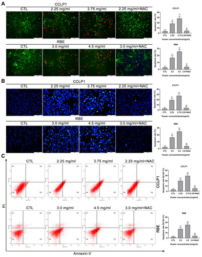 Figure 4 Huaier induces apoptosis in CCLP1 and RBE cells in vitro. (A) The AO/EB double-staining assays were used to test Huaier-induced apoptosis in CCLP1 and RBE cells. **P < 0.01 versus CTL. ##P < 0.01 versus Huaier (2.25 mg/mL for CCLP1 or 3.0 mg/mL for RBE) single treatment groups. CTL, control. (B) Huaier-induced apoptosis in CCLP1 and RBE cells was detected using Hoechst 33342 staining assays. **P < 0.01 versus CTL. ##P < 0.01 versus Huaier (2.25 mg/mL for CCLP1 or 3.0 mg/mL for RBE) single treatment groups. CTL, control. (C) Huaier-induced apoptosis in CCLP1 and RBE cells were analyzed using flow cytometry (Annexin V-FITC/PI double staining). Annexin V-FITC (-) and PI (-) cells were classified as alive, Annexin V-FITC (+) but PI (-) cells were classified as early apoptosis, Annexin V-FITC (+) and PI (+) cells were defined as late apoptosis. Annexin V-FITC (-) and PI (+) cells were defined as necrosis. The total rate of apoptosis was the sum of early apoptosis and late apoptosis. **P < 0.01 versus CTL. ##P < 0.01 versus Huaier (2.25 mg/mL for CCLP1 or 3.0 mg/mL for RBE) single treatment groups. CTL, control. Magnification, × 200 (A and B). Scale bar, 100 μm (A and B). Data are shown as mean ± SD of at least three independent experiments.Abbreviations: SD, standard deviation; AO/EB, acridine orange/ethidium bromide.