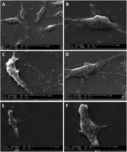 Figure 4. SEM micrographs of Schwann and adipose-derived mesenchymal stem cells cultured on culture slide. SEM micrographs showed bipolar or tripolar spindle morphology and elongated shape of SCs (A–D) compared to the flattened fibroblast-like morphology of the MSCs (E and F).