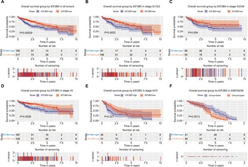 Figure 3 Survival analysis of EIF2B5 expression in terms of overall survival.Notes: Kaplan–Meier curves produced survival analysis (A) and subgroup analysis of histological grade (G1/G2 and G3/G4) (B and C) and clinical stage (I/II and III/IV) (D and E). Validation group of survival analysis in GSE54236 (F).