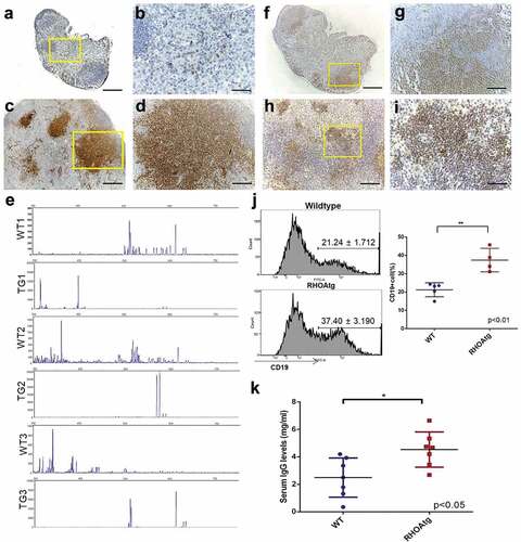 Figure 4. T-cell clonality and B-cell expansion in RHOA p.Gly17Val mice. (a-d) Sections from wild type (a, b) and transgenic (c, d) lymph nodes are stained with anti-CD3 antibody. The boxed regions in A and C are shown in enlarged forms in B and D, respectively. Note the scattered T-cells seen outside follicles in the wild type lymph node and the large clusters of T-cell colonies in the enlarged transgenic lymph node. (e) Lymph nodes from 3 litter mate pairs of wild type (WT) and transgenic (TG) mice were used for examination of TCR β chain diversity. 5ʹRACE PCR amplification of rearranged TCR β chain was carried out with oligonucleotide primers corresponding to the constant region. Products ranging from approximately 350 to750 bps in length were expected. Gene Scan results are consistent with oligo-clonality for affected transgenic lymph nodes. Wild type (f, g) and enlarged transgenic (h, i) lymph nodes were stained with anti-PAX5 antibody. The boxed regions in F and H are shown in enlarged forms in G and I respectively. Note the restricted localization of B-cells within the follicle in the wild type lymph node and scattered B cell clusters throughout the affected lymph node of the transgenic mouse. (j) Proportions of B cell are higher in the enlarged transgenic lymph nodes. Histograms from flow cytometric analyses using anti-CD19 are shown. The graph on the right side shows results from independent mouse samples. (**) represents P-value < 0.01 from t-test. (k) Results from ELISA show approximately two-fold increase in the serum IgG level in transgenic mice. (*) represents P-value < 0.05 from t-test. Scale bars represent: 50 μm for B, D, G, and I; 200 μm for A, C, F, and H.