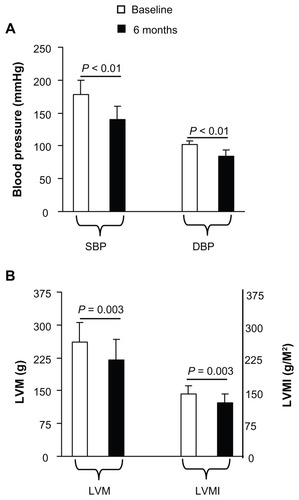 Figure 6 Effect of carvedilol on left ventricular hypertrophy in hypertensive patients.