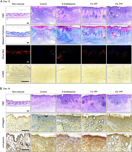 Figure 4. Topical application of TPF accelerates fibrous tissue and skin barrier recovery after cutaneous I/R injury. (A) Cutaneous pressure ulcer site stained with H&E, Masson’s trichome, picro-sirius red, and α-SMA antibody 12 days after I/R injury. Scale bar, 100 µm. (B) Cutaneous pressure ulcer site stained with H&E, and filaggrin and involucrin antibodies 16 days after I/R injury. Scale bar, 100 µm.