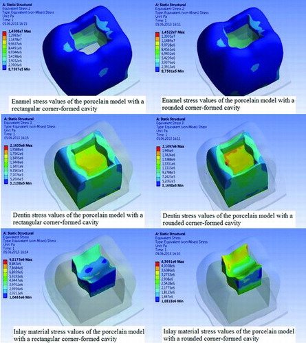 Figure 5. Stress analysis values for the porcelain ceramic group.