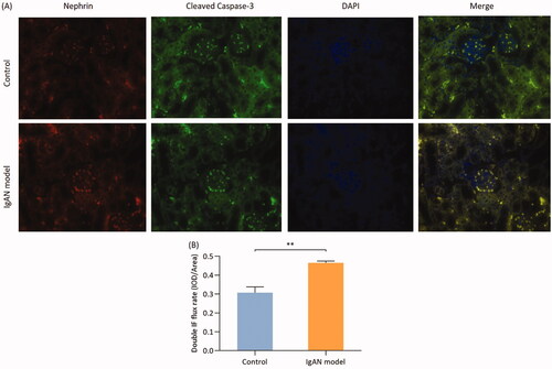 Figure 5. Colocalization of nephrin and cleaved caspase-3 in podocyte apoptosis in IgAN mice. (A) Double immunofluorescence was used to determine the expression of nephrin and cleaved caspase-3 in podocytes (magnification, x400). (B) Double immunofluorescence flux rate. Data are expressed as mean ± SD. *p < 0.05, **p < 0.01 vs. control group. IgAN, IgA nephropathy.