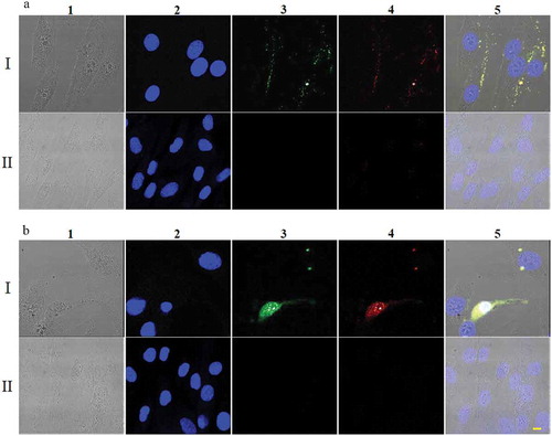 Figure 3. Uptake of FITC-ThioAp52-Dox by skin cells. Confocal laser scanning microscopy images of SK-MEL-28 (Rows I) and Hs895.Sk cells (Rows II) treated with 2.5 µM FITC-ThioAp52-Dox for 2 h (a) or 6 h (b). Columns 1) transmittance, 2) DAPI (blue), 3) FITC (for FITC-ThioAp52) (green), 4) Dox (red), and 5) superimposed image of 1) ~4). Yellow fluorescence in 5) indicates the localization of FITC-ThioAp52-Dox. Scale bar = 10 µm applies to all figures