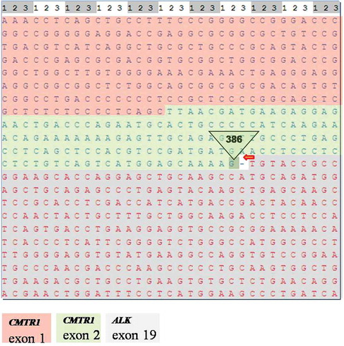 Figure 3. mRNA sequence of CMTR1-ALK fusion gene.