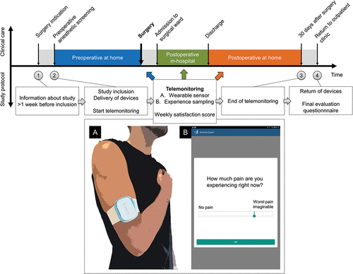 Figure 1. The study protocol in relation to the perioperative trajectory, including the elements of telemonitoring: (a) a wearable sensor (Everion®, Biovotion AG, Zürich, Switzerland), and (b) experience sampling (Activity Coach, Roessingh Research and Development, Enschede, The Netherlands [Citation15]).