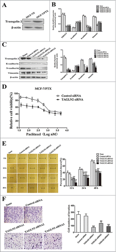 Figure 5. Transient knockdown of transgelin 2 by siRNA sensitized MCF-7/PTX cells to paclitaxel and inhibited migration and invasion abilities. (A) The expression of transgelin 2 in MCF-7/S and MCF-7/PTX cells was tested by western blot assay. (B) TAGLN2, E-cadherin, N-cadherin and Vimentin gene expression levels were compared in MCF-7/PTX cells transfected with TAGLN2 siRNA (0.1 nM) or control siRNA (0.1 nM) for 48 h. (C) The protein expression of transgelin 2, E-cadherin, N-cadherin and Vimentin were detected in MCF-7/PTX cells transfected with TAGLN2 siRNA or control siRNA. (D) MCF-7/PTX cells transfected with TAGLN2 siRNA or control siRNA for 48 h, were treated with various concentrations of paclitaxel and cell viability was examined by MTT method. (E) Migration of MCF-7/PTX cells transfected with TAGLN2 siRNA or Control siRNA was measured by wound healing assay (original magnification ×100). (F) Invasiveness of MCF-7/PTX cells transfected with TAGLN2 siRNA or control siRNA was detected by Transwell invasion assay (original magnification ×100). Data were presented as mean ± SD from 3 experiments. **P < 0.01 vs. control.