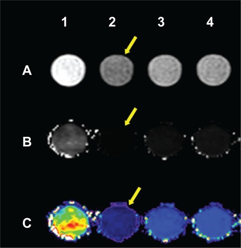 Figure 12 (A) T2-weighted, (B) T2-mapping, and (C) colored T2-mapping images.Notes: Test groups were incubated with different samples for 2 hours. The 2–4 groups set to 0.179 μg/mL Fe concentration. (1) Gelatin contrast with cells, which were not incubated with micelles; (2) Targeted group: folate-PEG-P(GA-DIP); (3) Non-targeted group: PEG-P(GA-DIP); (4) Competitive inhibition group: folate-PEG-P(GA-DIP) micelles with 1 mM free folic acid. Arrow: clear decreased signal in targeted group.Abbreviation: folate-PEG-P(GA-DIP), folate-poly(ethylene glycol)-b-poly[N-(N′,N′-diisopropylaminoethyl) glutamine].