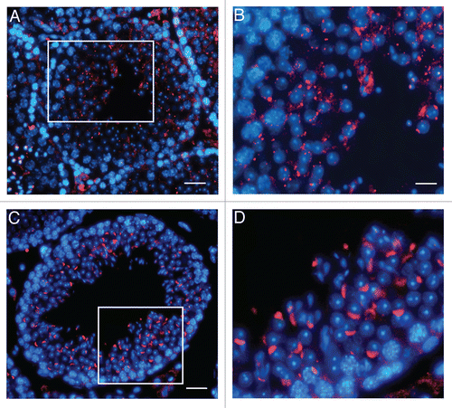 Figure 5 Localization of UBPy in testis from wr mice. Sections of wr (A and B) and wild-type (C and D) testes at stage VII of the seminiferous epithelial cycle were immunofluorescently labeled with antibodies to UBPy (red); DAPI (blue) was used to stain nuclei. Note the diffuse punctuate staining of UBPy in wr spermatids; in particular, the enlargement in (B) shows that no spermatid at step 7 exhibits the brightly fluorescent UBPy-immunostaining of the acrosomal cap characteristic of the wild-type step 7 spermatids (enlargement in D). Scale bars, 20 µm (A), 26 µm (C) and 10 µm (B and D).