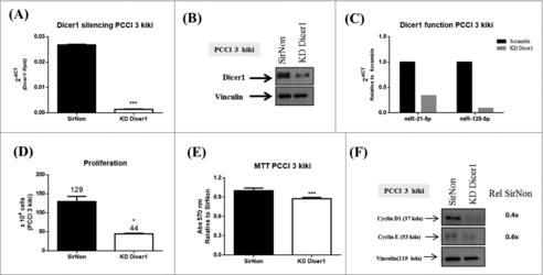 Figure 3. Dicer1 impacts the proliferation of KRAS-transformed PCCl 3 cells (PCCl 3 kiki). Cells were transfected with SirNon or Dicer1 specific siRNAs and (A) Dicer1 mRNA and (B) protein levels were assessed by q-RT-PCR and western blot, respectively. (C) To assess Dicer1 function, miR-21-5p and miR-125-5p expression were evaluated by q-RT-PCR in the same conditions. (D) Number of PCCl 3 kiki cells was counted using trypan blue 48 hours post transfection with SirNon or specific Dicer1 siRNAs. (E) Cell viability was assessed using MTT assay in the same conditions. (F) Expression of cyclin D1 and E by western blot 48 hours after the transfection of PCCl 3 kiki cells with SirNon or specific Dicer1 siRNA. Densitometry intensity quantification was calculated as ratio target: vinculin and relative to SirNon. Vinculin was used a loading control for western blot. Rpl4 was used as housekeeping gene. *p < 0.05; ***p < 0.001.