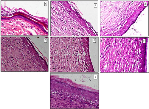 Figure 9 Histopathological examination at 500× magnification power of (a) normal skin, (b) control untreated group, (c) treated with verapamil HCl gel, (d) treated with placebo PVA-SA nanofibers (N2), (e) treated with placebo PVA-Z nanofibers (Z4), (f) treated with verapamil HCl-loaded PVA-SA nanofibers (N6), (g) treated with verapamil HCl-loaded PVA-Z nanofibers (Z5), on day 14 post-wounding.