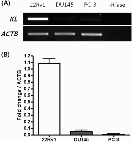 Figure 2. Expression of the KLOTHO mRNA in the prostate cancer cell lines.