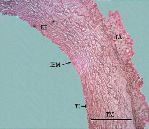 Figure 1.  Photomicrograph – the tunica media of canine common carotid artery with several continuous and concentric elastic lamellae. TI, tunica intima; TM, tunica media; TA, tunica adventitia; IEM, internal elastic membrane; EF, elastic fibres. Orcein stain, 280×, Bar = 35.7 µm.