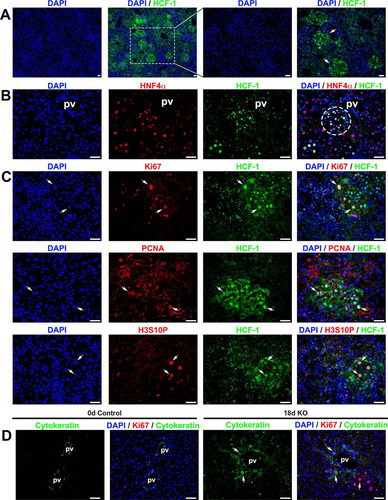 FIG 7 Progenitor cell population is activated in Hcfc1hepKO/Y male livers by 18 days after tamoxifen treatment. Immunofluorescence analyses of paraffin-embedded sections from Alb-Cre-ERT2tg; Hcfc1hepKO/Y male livers 18 days after tamoxifen treatment are shown. (A) Staining with DAPI (blue) and HCF-1 antibody (green). Both low and high magnifications of the same section are shown. The arrows point to distinct HCF-1-positive clusters. (B) Staining with DAPI (blue) as well as HNF4α (red) and HCF-1 (green) antibodies. The circle highlights a periportally located HNF4α- and HCF-1-positive hepatocyte cluster. (C) Staining with DAPI (blue) and HCF-1 (green) antibody and, in red, either Ki67 (top), PCNA (middle), or H3S10P (bottom) antibody. Arrows point to Ki67-positive, PCNA-positive, or H3S10P-positve hepatocytes that are also HCF-1 positive. (D) Staining with DAPI (blue) as well as Ki67 (red) and cytokeratin (green) antibodies. White arrows point to periportal Ki67- and cytokeratin-positive cells. The yellow arrow points to a cluster of cells with hepatocyte morphologies. pv, portal vein. Scale bars, 50 μm.