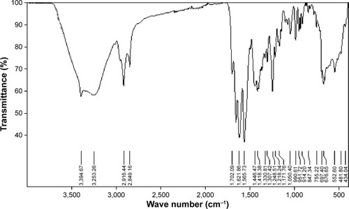 Figure 7 Infrared spectrum analysis of biliary stent sediment.
