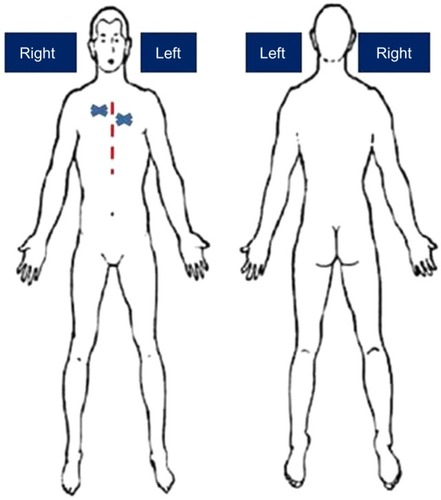Figure 1 The area of the body affected by discomfort.