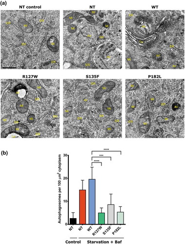 Figure 2. HSPB1 mutations decrease the number of autophagic vesicles upon autophagy stimulation. Transmission electron microscopy of HeLa cells transduced or not (NT) with a plasmid encoding V5-tagged WT HSPB1, the mutant forms (R127W, S135F, P182L) and treated or not (NT control) with serum starvation and 10 nm bafilomycin A1 (Baf). (a) Representative images of the different genotypes. Scale bar: 500 nm. AV, autophagic vesicle; Go, Golgi; ER, endoplasmic reticulum; Mi, mitochondrion; Ly, primary lysosome. (b) Quantification of the number of autophagosomes. Autophagosomes were identified based on ultrastructural morphological characteristics. Per cell, the total number of autophagosomes present on the section was counted and expressed per cytoplasmic area covered. One-way ANOVA, with Tukey’s correction range test. Error bars = mean with S.D. *** = p < 0.001 **** = p < 0.0001.