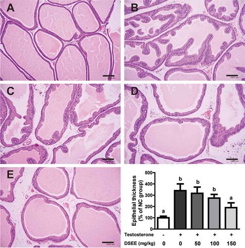 Figure 2. Histopathological observations and epithelial thickness of the ameliorative effect of Donganme sorghum ethyl-acetate extract (DSEE) on benign prostatic hyperplasia (BPH) in rats treated with testosterone (hematoxylin and eosin stain). (a) Normal control (NC) group. (b) BPH control group, subcutaneously injected with 3 mg/kg testosterone 5 days a week for 2 weeks. (c) BPH + DSEE 50 mg/kg group. (d) BPH + DSEE 100 mg/kg group. (e) BPH + DSEE 150 mg/kg group. Scale bar indicates 100 μm. Values represent the mean ± SE. a and b indicate statistical differences from the groups labeled with different letters (p < 0.05).