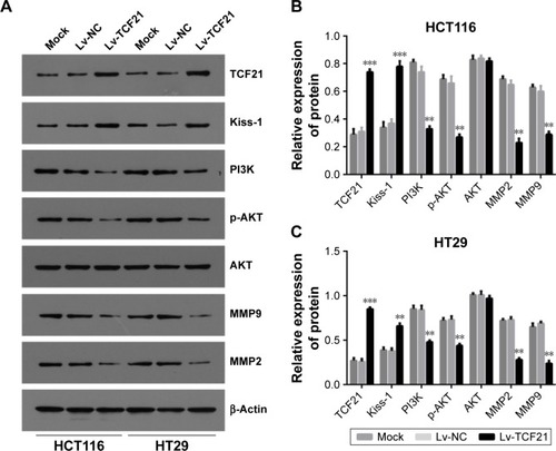 Figure 5 TCF21 regulates key molecules of PI3K signaling and MMPs.