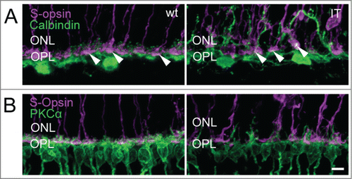 Figure 6. Structural integrity of horizontal cells and cone terminals of wild type and Cav1.4-IT retinas. Labeling against (A) S-opsin (magenta) and Calbindin (green) (B) S-opsin and PKCα (green) is shown. Calbindin staining in wild type showed puncta, corresponding to the fine dendritic tips of horizontal cells approaching the synaptic cavity of cone terminals (arrowheads). In Cav1.4-IT mice the dendrites of horizontal and rod bipolar cells were clearly elongated into the outer nuclear layer (ONL). Some connections between these 2 second order neurons and cone photoreceptor were visible (white puncta, arrowheads). OPL, outer plexiform layer. Scale bar, 10 µm.