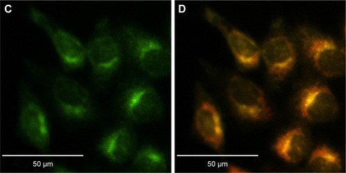 Figure 4 Lysosome colocalization experiments.Notes: (A) DIC and confocal fluorescence micrographs of HCT-116 cells incubated with PEG–PAG9 (B; red) and LysoTracker Green (C). Overlay image (D) shows PEG–PAG9 mainly built up in lysosomes and endosomes. Pearson’s correlation coefficient =0.92.Abbreviations: DIC, differential interference contrast; PEG, polyethylene glycol; PAG, photoacid generator.