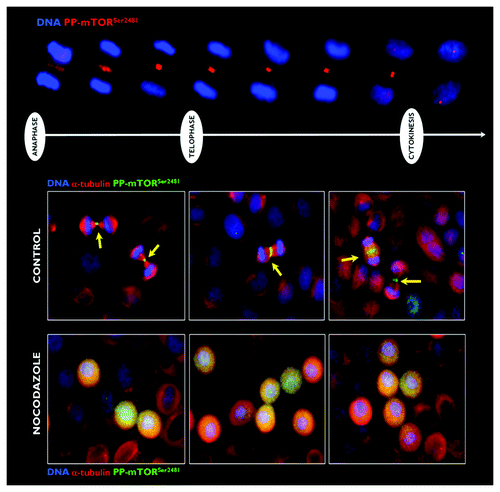 Figure 3. Effect of microtubule depolymerization on the central spindle/midzone localization of phospho-mTORSer2481. Top: Spatiotemporal dynamics of phospho-mTORSer2481 during mitosis and cytokinesis in A431 epidermoid cancer cells, which were double-stained with antibodies against phospho-mTORSer2481 (red) and Hoechst 33258 (blue) for nuclear counterstaining. Bottom: Representative images of asynchronous A431 cell cultures propagated under normal conditions (leftpanels) or exposed to 0.2 μg/mL nocodazole for 6-h G2 arrest (right panels). Images were captured with a 20x objective in the channels corresponding to phospho-mTORSer2481 (green), α-tubulin (red) and Hoechst 33258 (blue), and the images were merged with a BD Pathway™ 855 Bioimager System using BD Attovision™ software.
