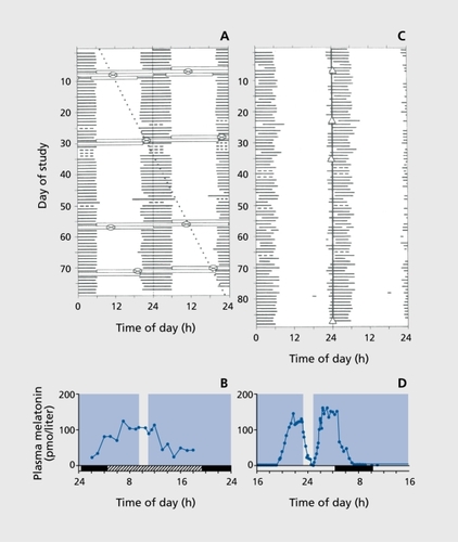 Figure 5. Absence and presence of circadian photoreception in two totally blind subjects. Panels A and C: Subjects completed daily sleep and nap diaries for ~11 to 12 weeks and their sleep times (solid lines) are double-plotted according to convention in Figure 3. Subjects also had their circadian phase measured at regular intervals from either core body temperature minimum ((+) Panel A) or plasma melatonin onset (Δ Panel C). Panels B and D show the results of a melatonin suppression test during which the subjects' eyes were exposed to bright white light (6000 to 13 700 lux) for 90 to 100 minutes during plasma melatonin production. Panels A and B show the sleep-wake pattern and melatonin suppression response for a 70-year-old blind man with congenital glaucoma. He retained both eyes but reported no conscious light perception. Electroretinogram (ERG) and visually evoked potential (VEP) responses were not detectable. As shown in Panel A, the subject's circadian system was not entrained to the light-dark cycle and the core body temperature rhythm exhibited a non-24-hour period. Consistent with the lack of entrainment by light light exposure did not have any effect on the melatonin rhythm, confirming that the retina-SCN-pineal pathway was not functional in this patient. Panels C and D show the sleep-wake pattern and melatonin suppression results for a 21-year-old woman with Leber's congenital amaurosis, a type of retinal dystrophy The ERG was undetectable but an abnormal VEP was recorded. As shown in Panel C, the sleep-wake cycle was normal with stable entrainment to 24 hours. The melatonin suppression response was clearly positive, with an immediate suppression of melatonin at lights on (open bar) which ceased once the bright lights were switched off. Despite the subject's lack of conscious light perception, light was still able to stimulate the retina-SCN-pineal pathway; covering the eyes prevented the response. The normal sleep-wake cycle, coupled with the positive melatonin suppression test indicated that light was able to entrain the circadian system of this totally blind woman. Note: a similar sleep-wake pattern but accompanied by a negative melatonin suppression test would indicate that (i) the subject was entrained to 24 hours by a nonphotic time cues or (ii) the subject's endogenous circadian period was exactly 24 hours. SCN, suprachiasmatic nucleus. Reproduced from reference 74: Czeisler CA, Shanahan TL, Klerman E., et al. Suppression of melatonin secretion in some blind patients by exposure to bright light. N Engl J Med. 1995;332:6-11. Copyright © Massachusetts Medical Society 1995