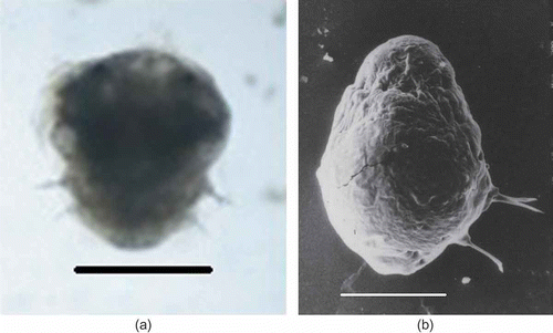 Figure 5. Marphysa gravelyi. Late metatrochophore. (a) Light microphotograph; (b) electron microphotograph. Scale bar: 100 μm.