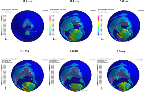 Figure 11 Sequential strain strength response of ocular surface of model eye upon airbag impact in 30°-gaze down position at 60 m/s with adhesion strength of scleral flap of 30%, shown at 0.4-ms intervals after 0.2 ms. Strain strength change is displayed in color as presented in the color bar scale (Figure 2).