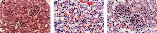 Figure 2. Effect of exogenous normal lymph on renal morphological change in disseminated intravascular coagulation (DIC) rats [hematoxylin and eosin (HE) staining, ×200]. (A) Control group. (B) Model group. (C) Lymph group.