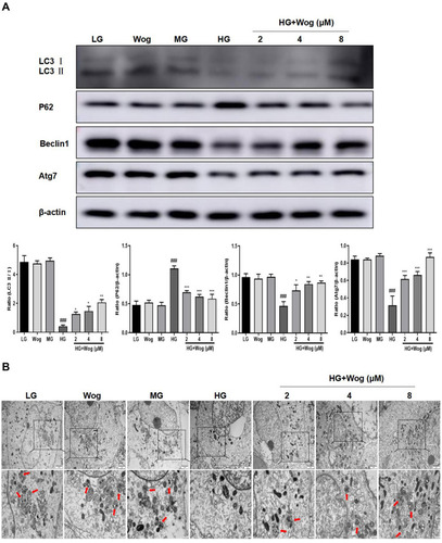 Figure 6 Wogonin attenuates autophagic dysfunction in HG-treated HK-2 cells. (A) Western blot analysis of LC3, P62, Beclin1 and Atg7 and in HK-2 cells. (B) Representative transmission electron microscopy of autophagosome in HK-2 cells. In the enlarged view of the boxed area, autophagic vacuoles (red arrowhead indicate autolysosome), Scale bar = 500nm. Results represent means ± SEM for three independent experiments. ###p < 0.001 VS LG. *p < 0.05, **p < 0.01, ***p < 0.001 VS HG.