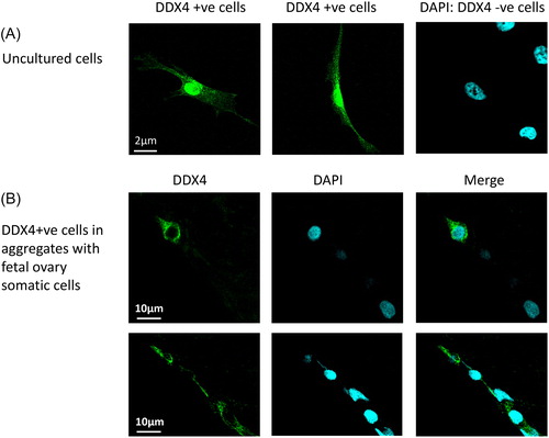 Figure 2. (A) Immunocytochemistry of DEAD box polypeptide 4 (DDX4) expression in freshly sorted human putative oogonial stem cells (‘uncultured cells’), with 4′,6-diamidino-2-phenylindole (DAPI) staining of DNA in DDX4-negative cells (centre panel, and merged image (right panel). (B) DDX4 and DAPI staining of putative oogonial stem cells after culture in aggregates of human fetal ovarian somatic cells. Methods as described in Clarkson et al.Citation15.