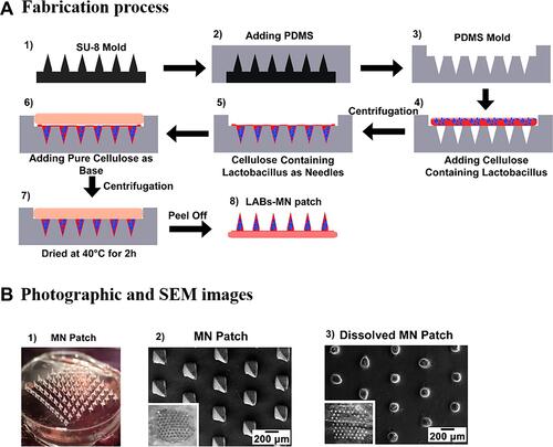 Figure 1 Fabrication of the dissolvable microneedle patches loaded with Lactobacillus: (A) Fabrication process and (B) Photographic and SEM images; Adapted with permission from Chen HJ, Lin DA, Liu F, et al. Transdermal delivery of living and biofunctional probiotics through dissolvable microneedle patches. ACS Applied Biomater. 2018;1(2):374–381. Copyright © 2018, American Chemical Society.Citation82