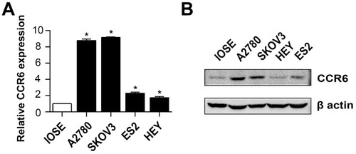 Figure 2 CCR6 expression in ovarian cancer cell lines.