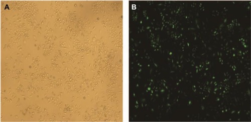 Figure 1 The transfection efficiency of lentivirus after transfecting SiHa cells for 48 hours.Notes: (A) Image of SiHa cells at normal light (×100). (B) GFP expression in SiHa cells following transfection with S100A9-pLVX-IRES-ZsGreen1 lentivirus at fluorescent (×100). The transduction efficiency of lentivirus was 93%.