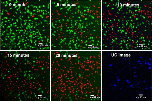 Figure 5 Confocal fluorescent microscopy images of MCF-7 cells incubated with 50 μg mL−1 UCN-Ce6 counterstained with fluorescein diacetate/propidium iodide after 980 nm NIR irradiation (191 mW cm−2).Abbreviations: Ce6, chlorin e6; NIR, near-infrared; UCN, upconversion nanoparticle.