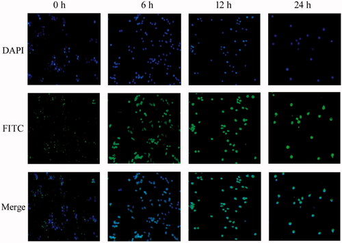 Figure 4. Fluorescence microscope of cellular uptake of nanoparticles on RAW264.7 cells. Blue, DAPI for nuclear staining; green, FITC-labeled nanoparticles.