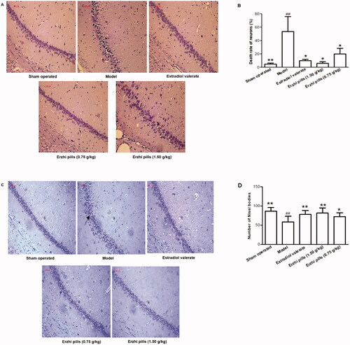 Figure 5. Effect of Erzhi pills on the morphology and number of hippocampal neurons in AD model rats induced by ovariectomy as well as d-galactose and Aβ1–40 injection. (A) The effect of the Erzhi pills on the CA1 cells in AD rats (HE staining, 200×). (B) The effect of Erzhi pills on neurons necrosis rate in hippocampal CA1 area of AD rats. (C) The effect of Erzhi pills on hippocampal CA1 region neurons of AD rats (Nissl staining, 200×). (D) The effect of Erzhi pills on the number of Nissl bodies in hippocampal CA1 area of AD rats. ##p < 0.01, vs. Sham-operated group; *p < 0.05, **p < 0.01, vs. model group. Mean ± SD, n = 6.