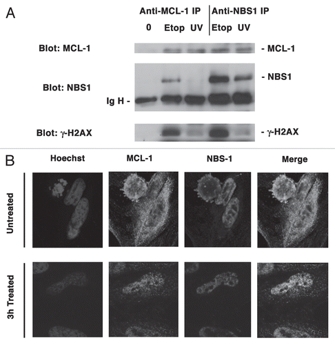 Figure 6 MCL-1 co-immunoprecipitates with NBS1 following DNA damage. (A) HeLa cells were either untreated (0) or treated with Etoposide (Etop) for 3 h or exposed to UVB radiation (UV) for 20 s and allowed to recover for 3 h. Total nuclear extracts were immunoprecipitated with anti-MCL-1 antibody or anti-NBS1 antibody and probed for MCL-1, NBS1 or γ-H2AX. (B) HeLa cells were untreated or treated with etoposide for 3 h. Cells were fixed and stained with anti-MCL-1 or anti-NBS1 antibodies and visualized by confocal microscopy using goat anti-rabbit Alexa Fluor 488 (green; for MCL-1) or goat anti-mouse Alexa Fluor 594 (red; for NBS1). Nuclei were stained with Hoechst 33342.